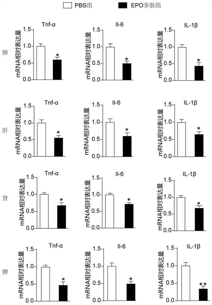 Application of EPO (erythropoietin) analogue in preparation of medicine for treating sepsis