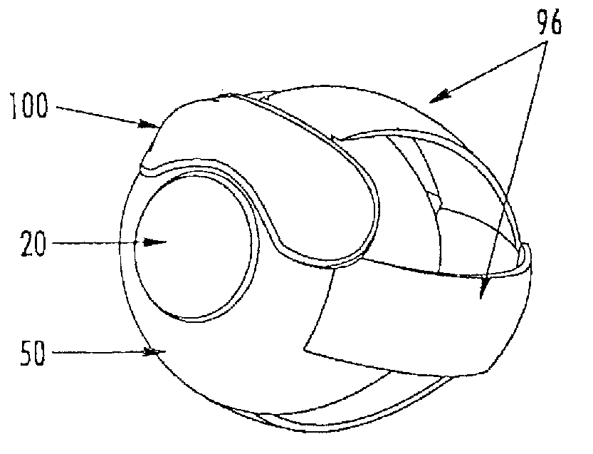 Ophthalmic drug delivery system and applications