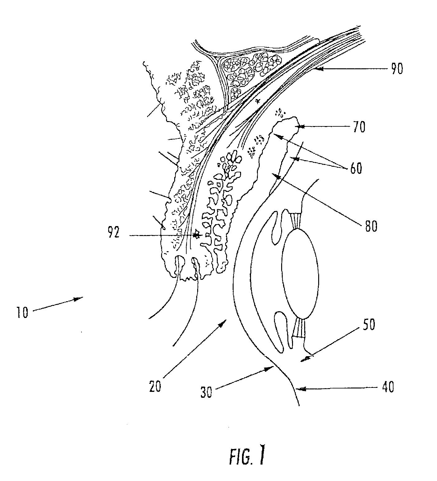 Ophthalmic drug delivery system and applications