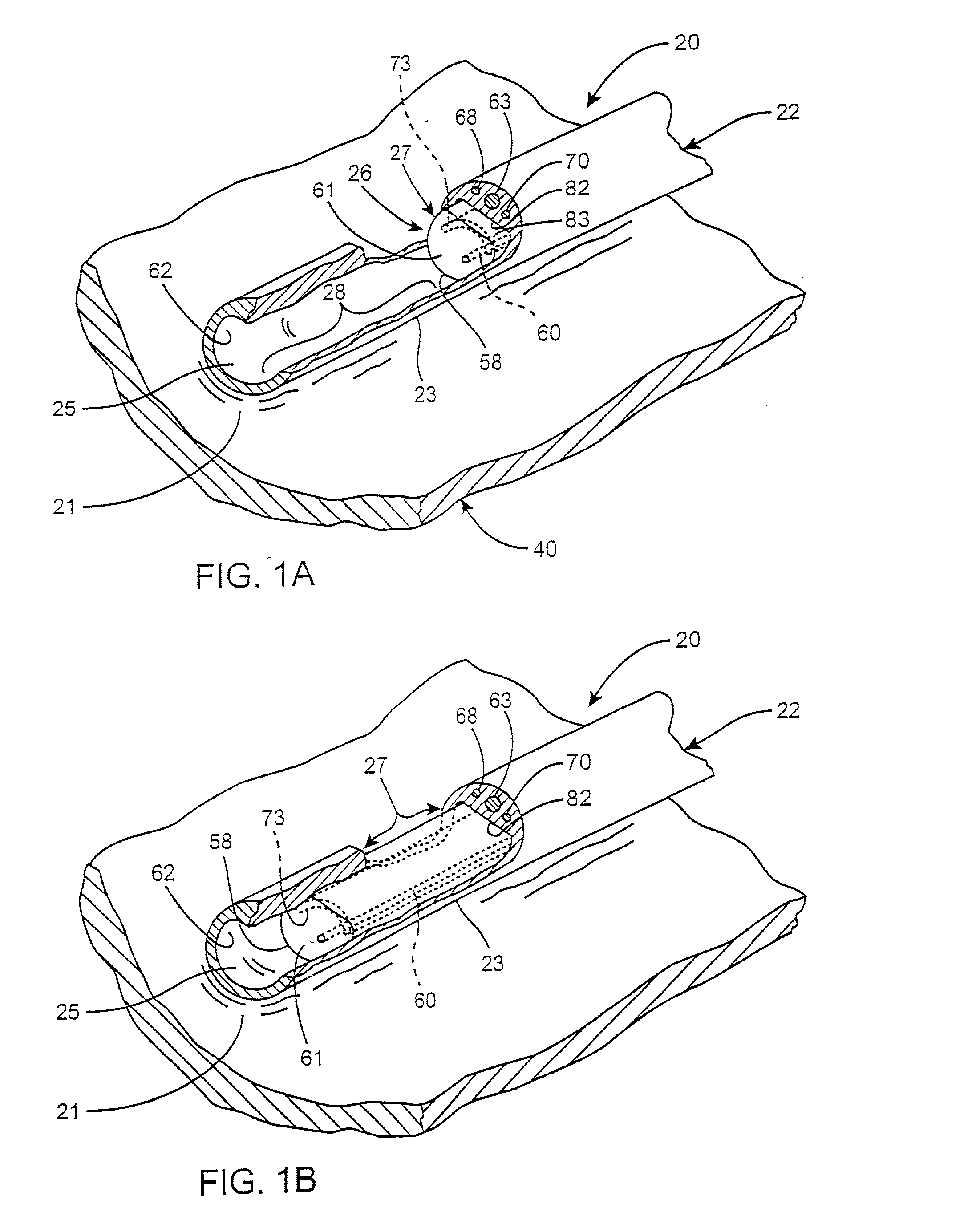 Medical instrument positioning tool and method