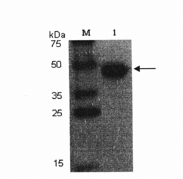 Method for producing American cockroach allergen protein Pera 9 in baculovirus-insect expression system