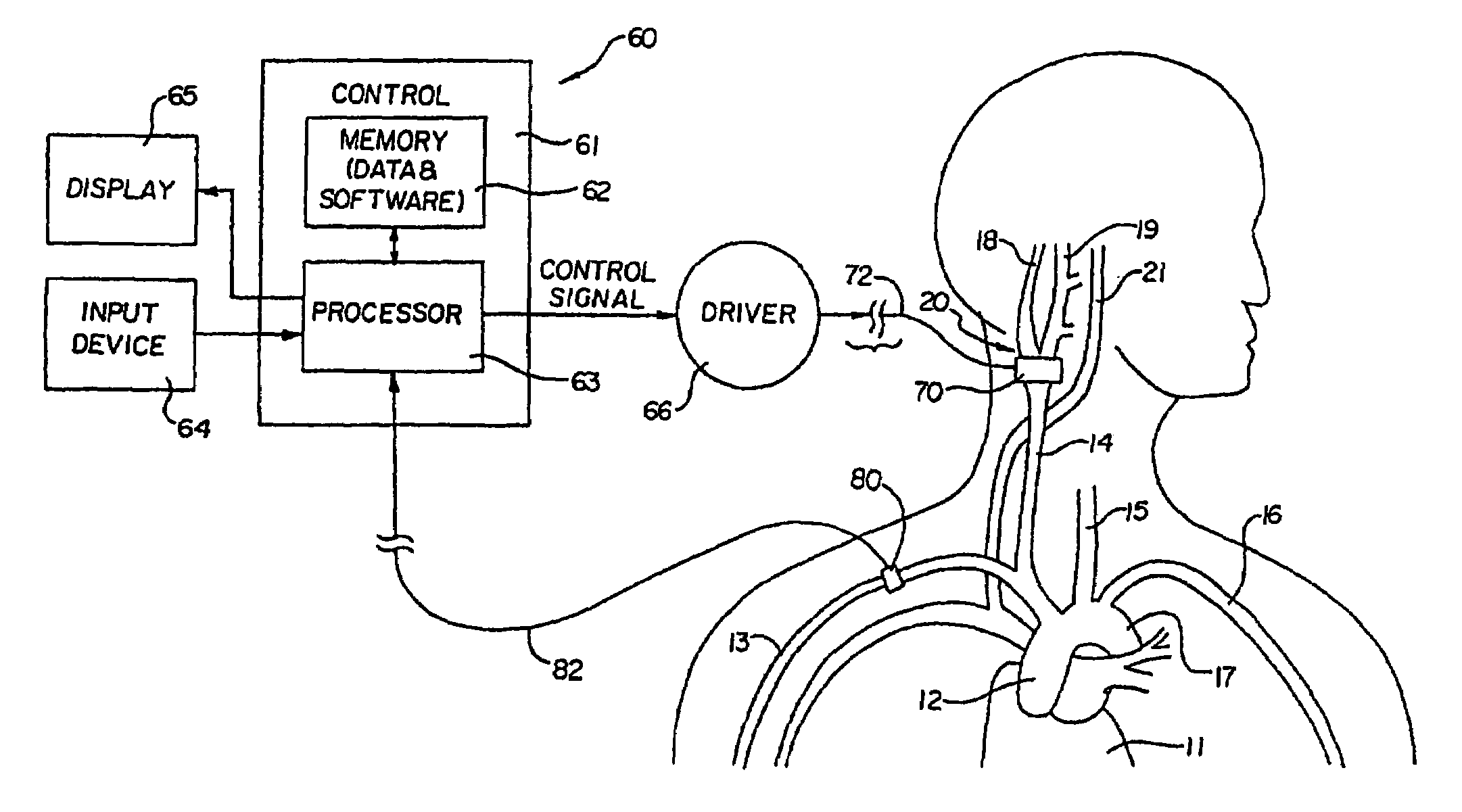 Stimulus regimens for cardiovascular reflex control