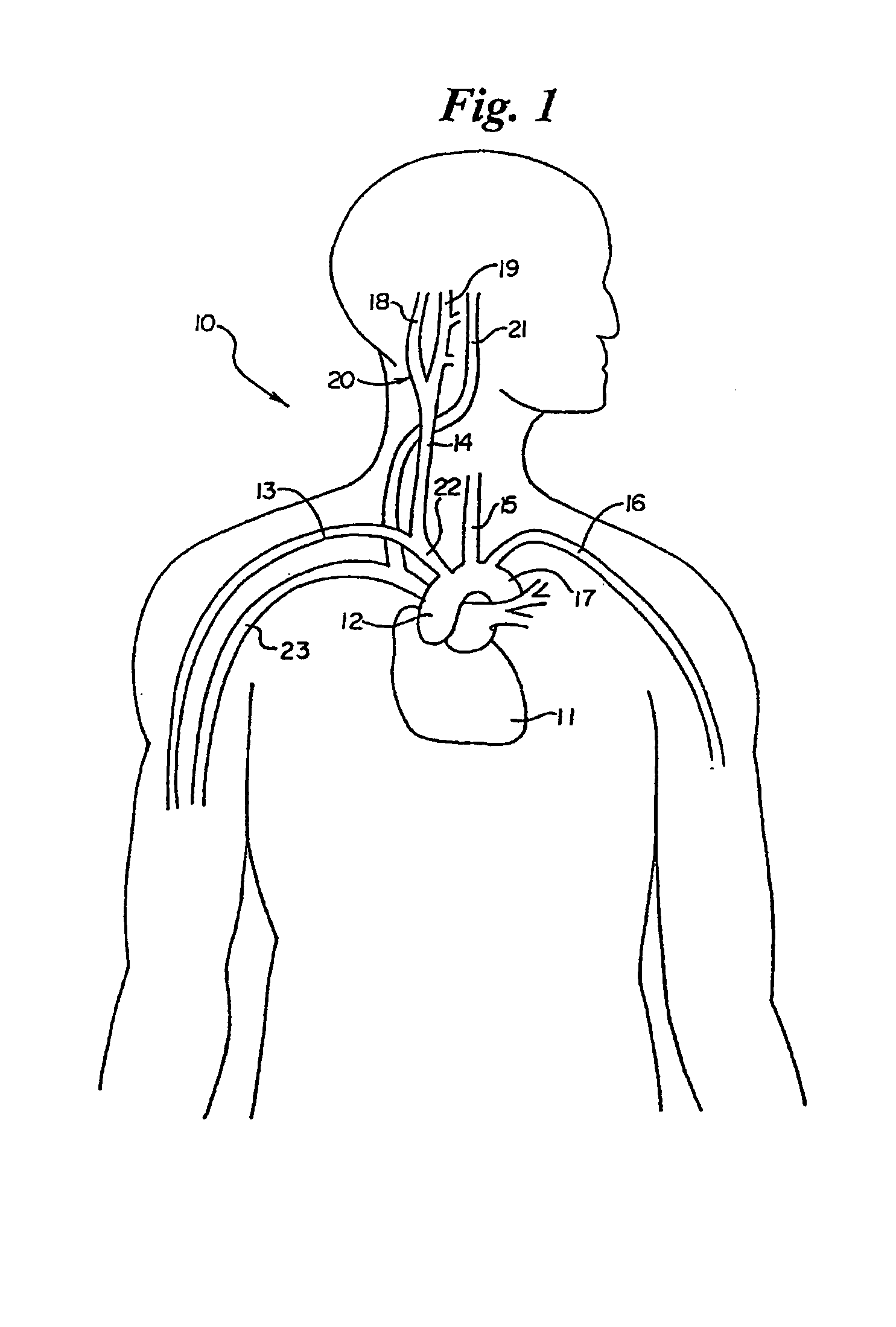 Stimulus regimens for cardiovascular reflex control