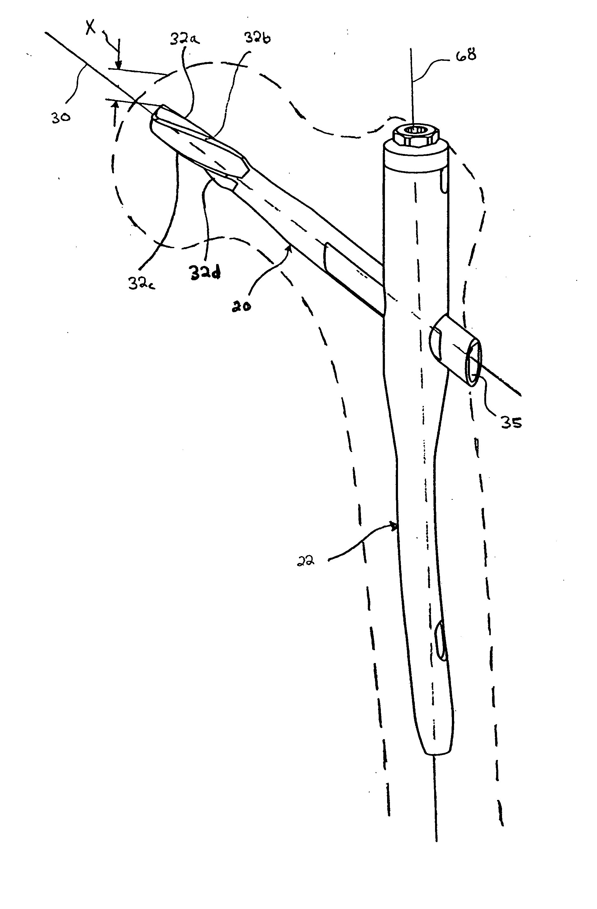 Bone fixation system