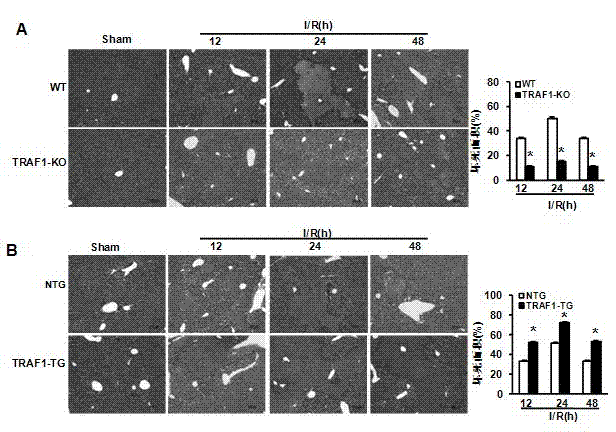 TNF (Tumor Necrosis Factor) receptor associated factor 1 (TARF1) and application of inhibitor thereof to liver ischemic disease