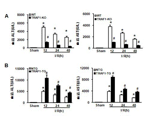 TNF (Tumor Necrosis Factor) receptor associated factor 1 (TARF1) and application of inhibitor thereof to liver ischemic disease