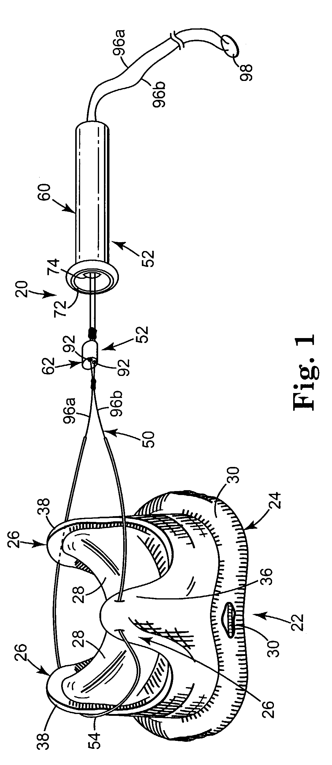 Prosthetic heart valve system