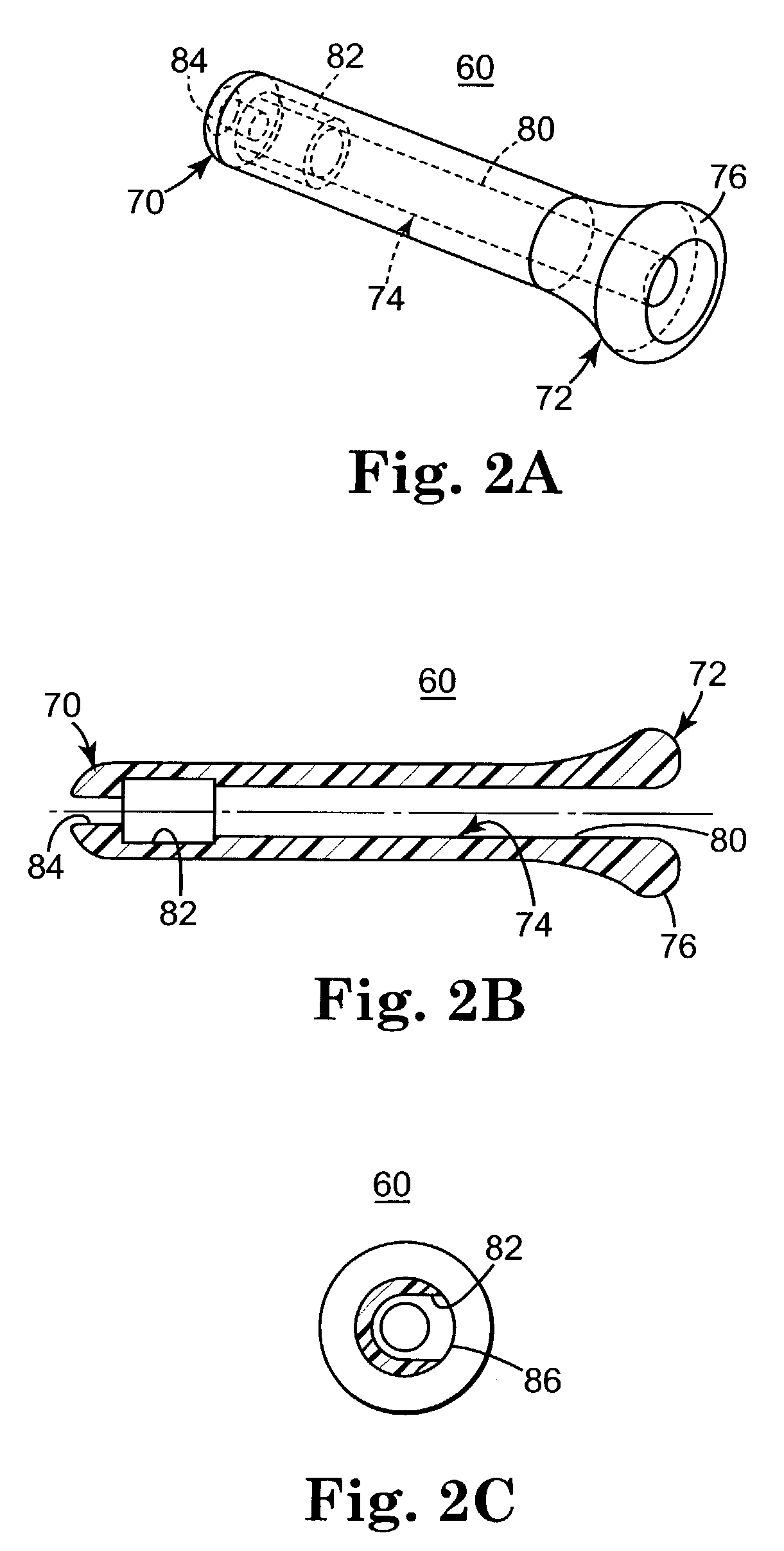 Prosthetic heart valve system