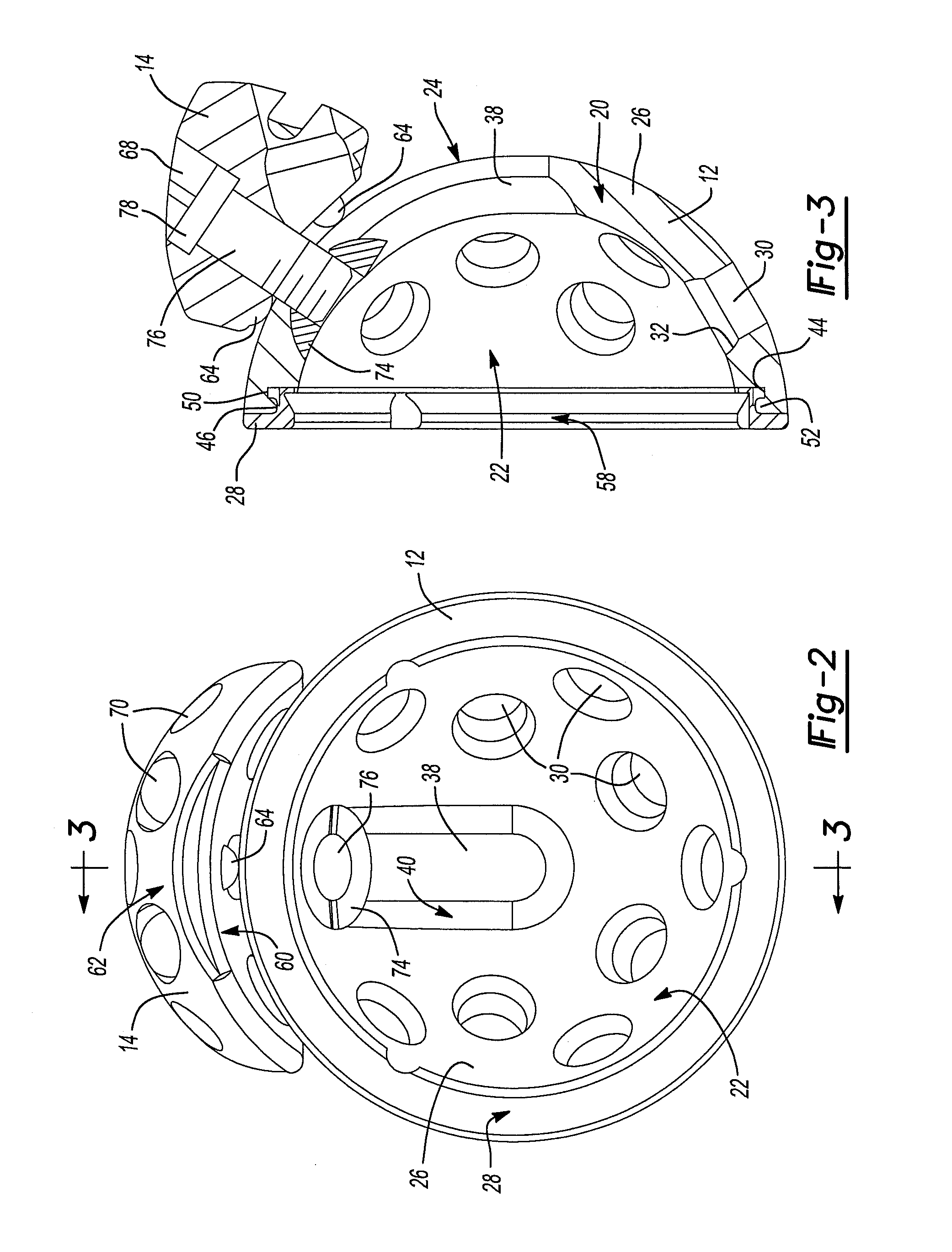 Acetabular Cup Having An Adjustable Modular Augment