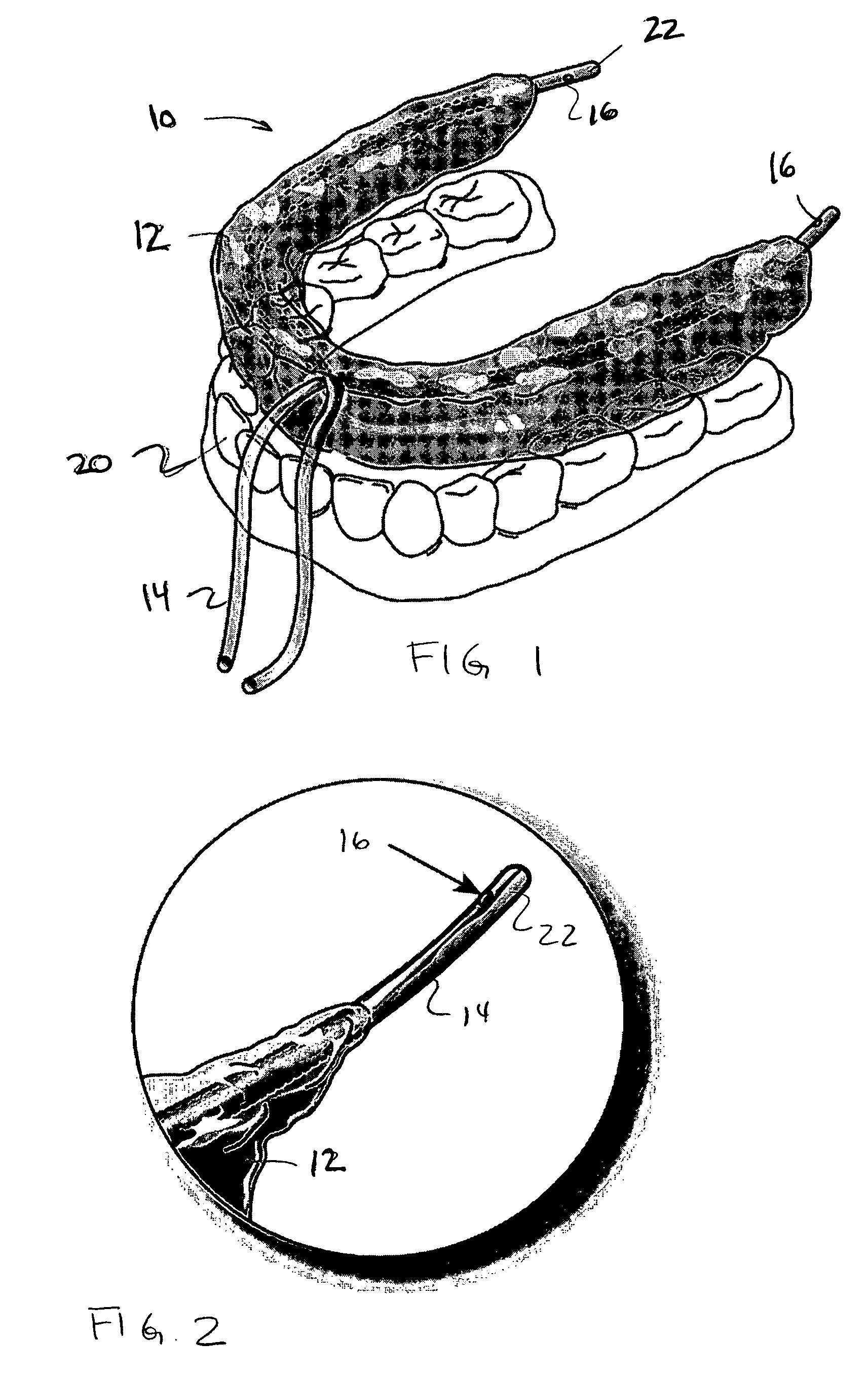 Oral device