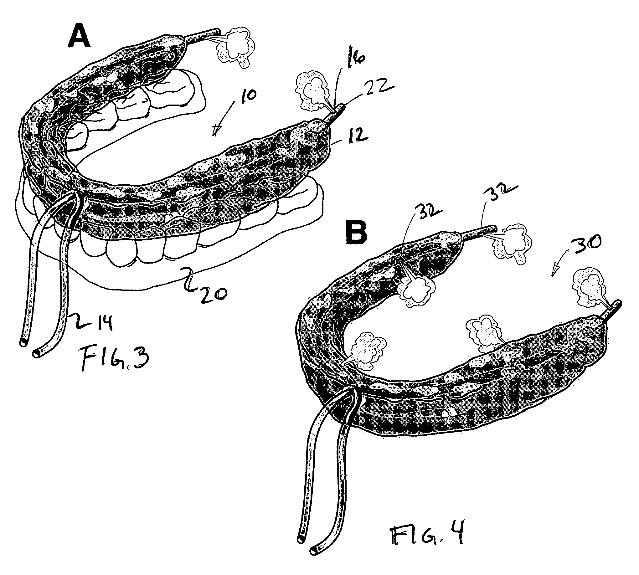 Oral device