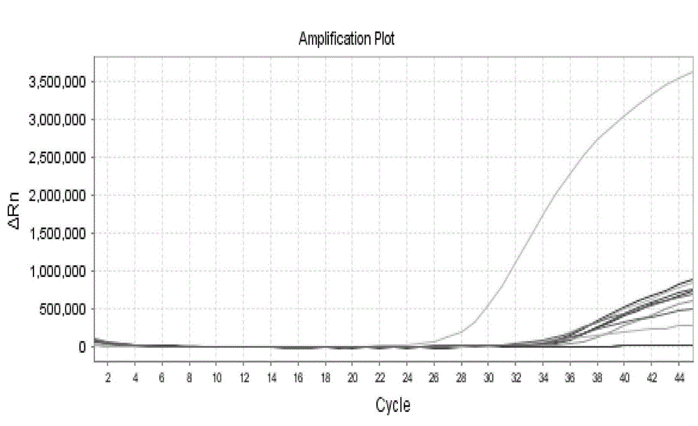 Fluorescence quantitative PCR primer, probe and kit for detecting ordinary pathogenic fungi