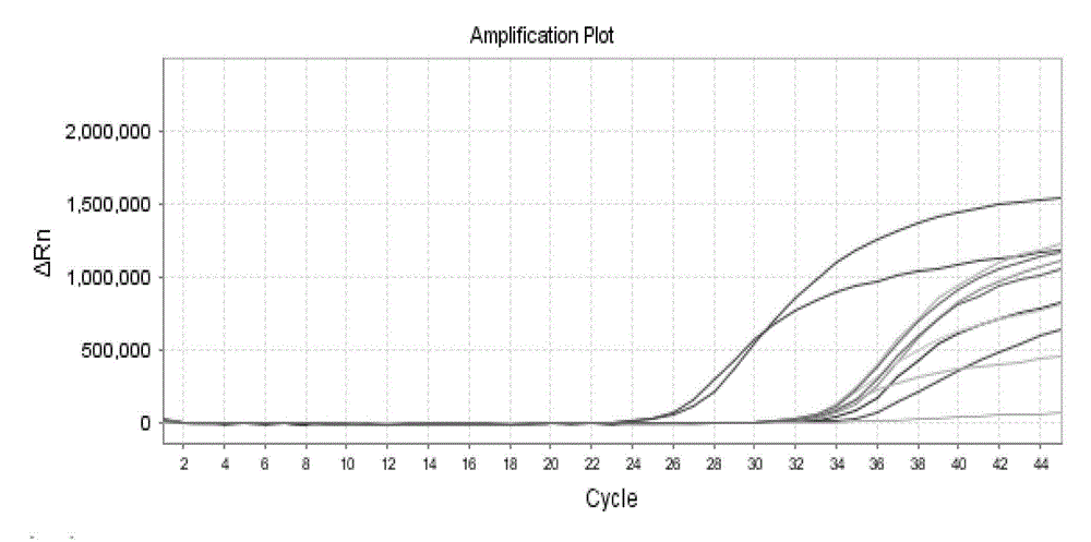 Fluorescence quantitative PCR primer, probe and kit for detecting ordinary pathogenic fungi