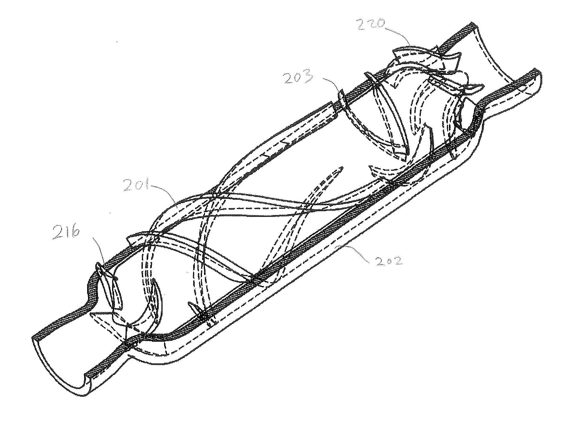 Blood pump with separate mixed-flow and axial-flow impeller stages and multi-stage stators