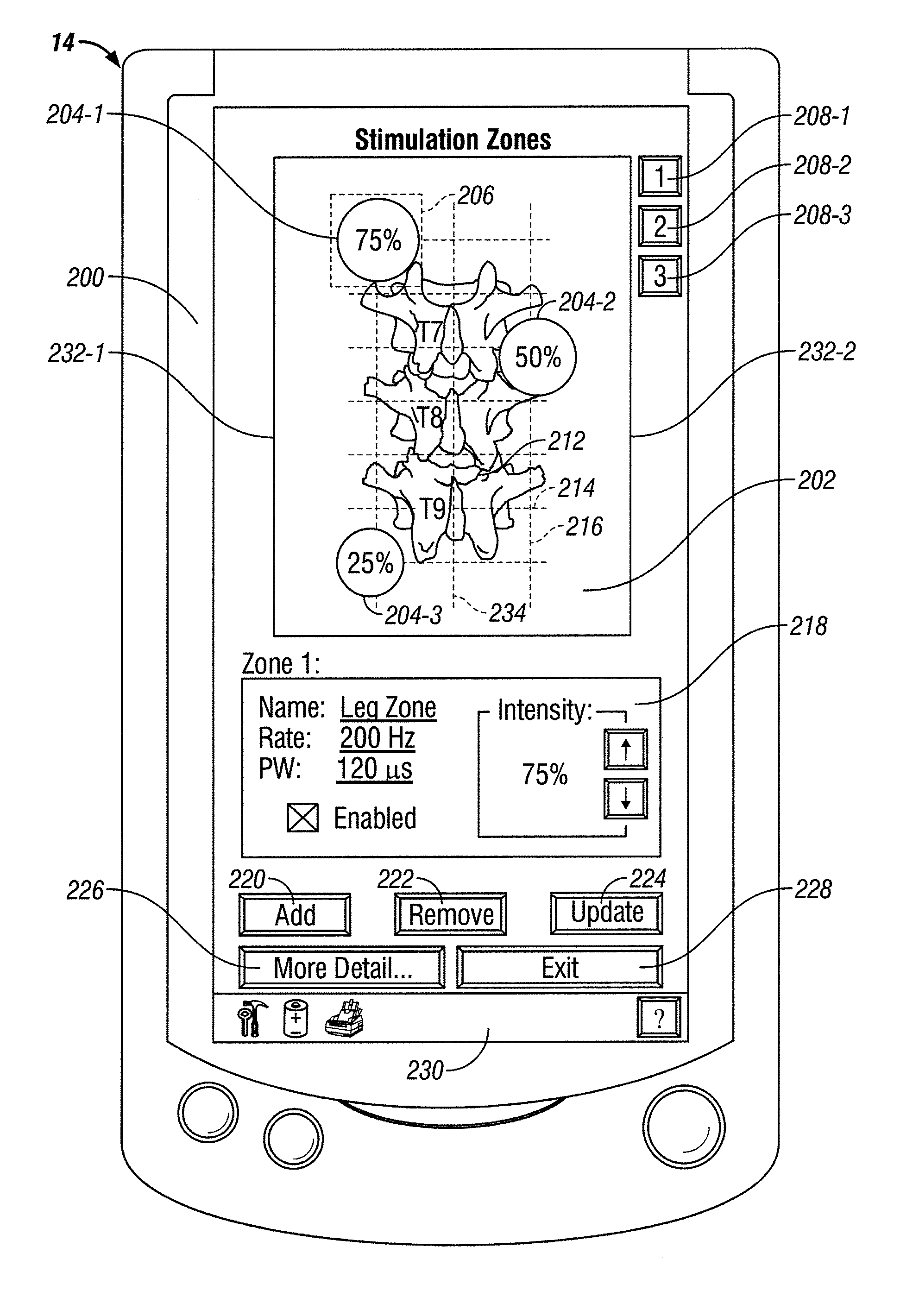 Human-implantable-neurostimulator user interface having multiple levels of abstraction