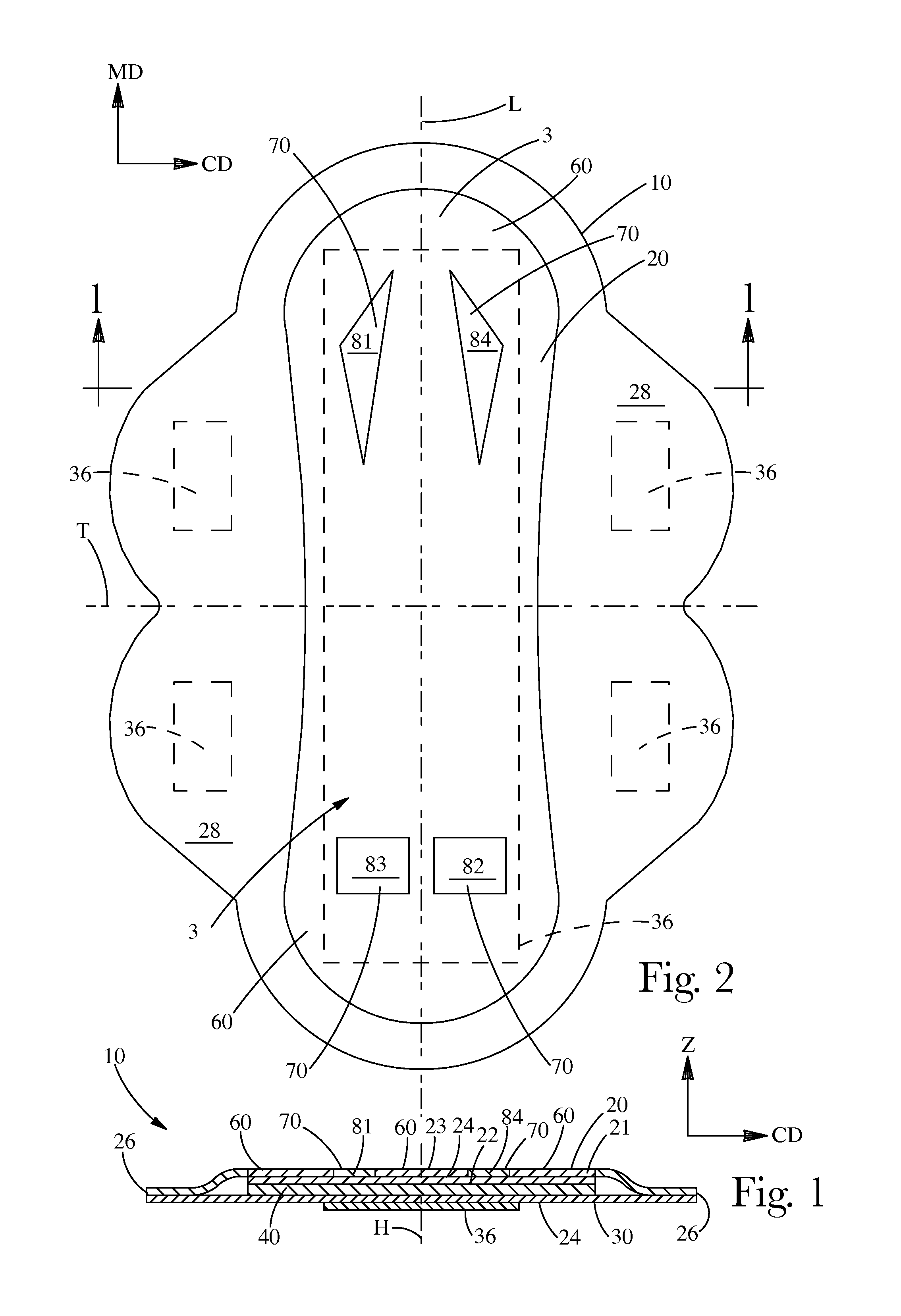 Absorbent article comprising fluid handling zones