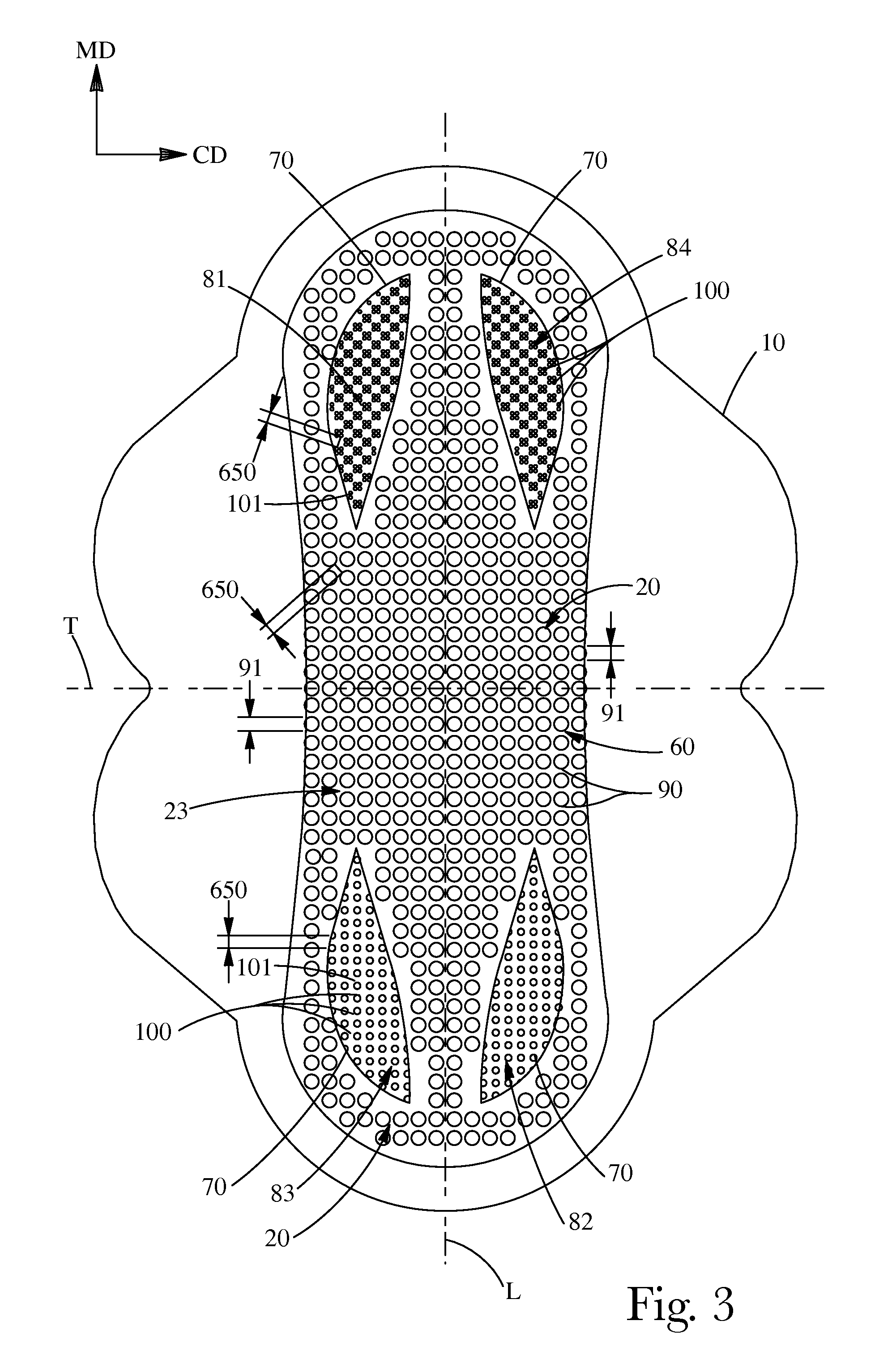 Absorbent article comprising fluid handling zones