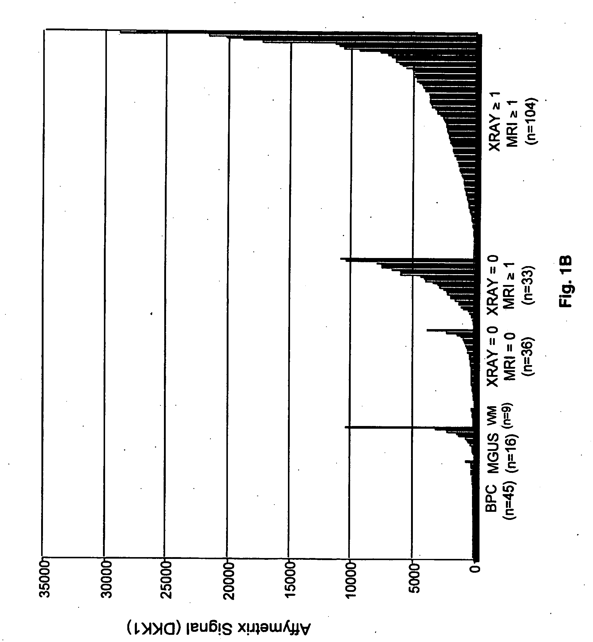 Molecular determinants of myeloma bone disease and use thereof