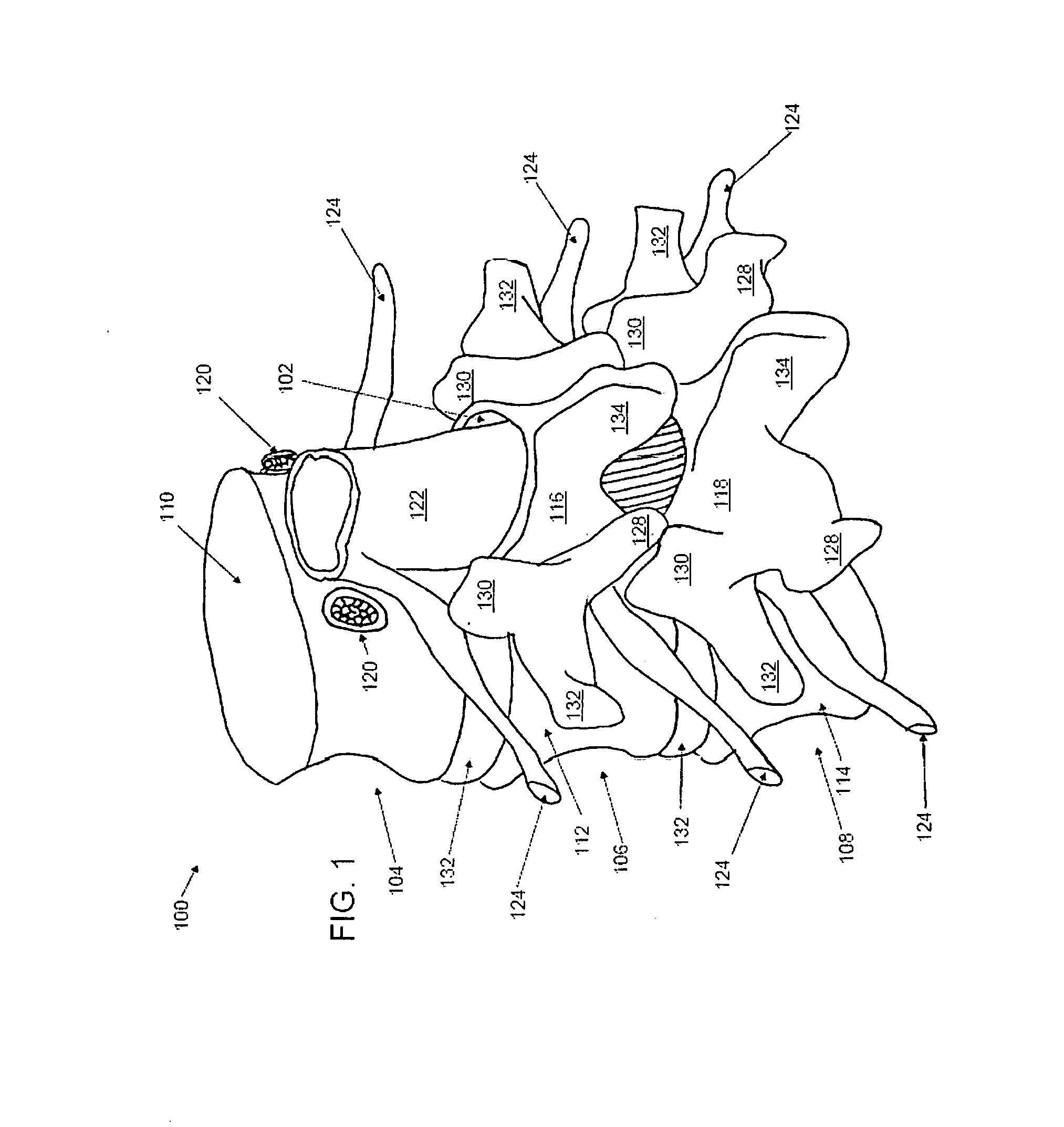 Discectomy devices and methods