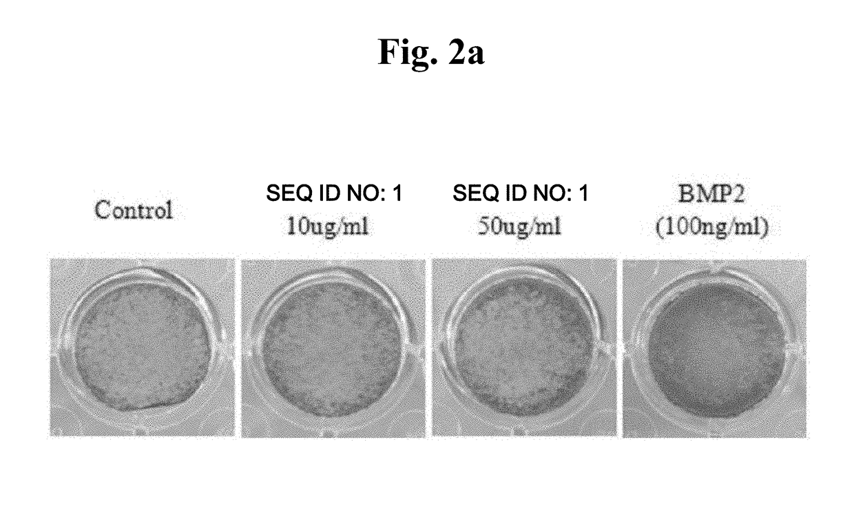 Peptide having osteoblast proliferation activity and periodontal ligament fibroblast proliferation activity, and use of same