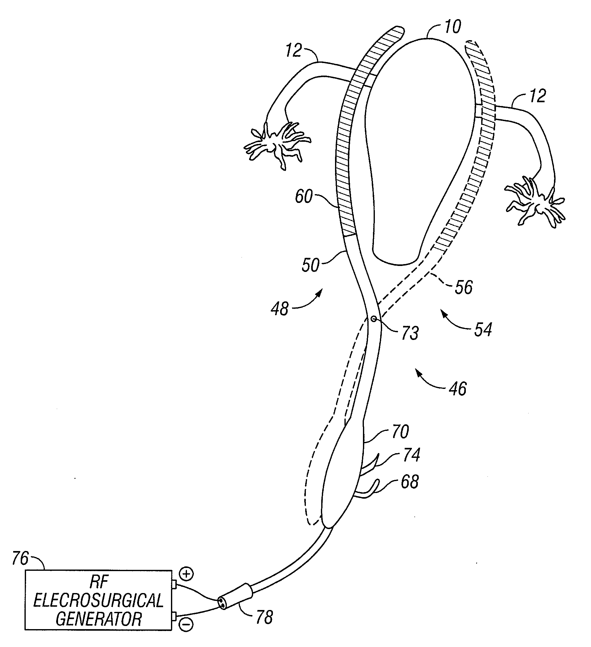 Method and apparatus for sealing tissue