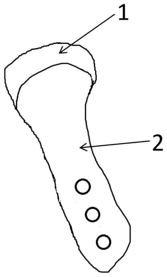 Elastic bionic artificial temporomandibular zygopophysis prosthesis and preparation method thereof