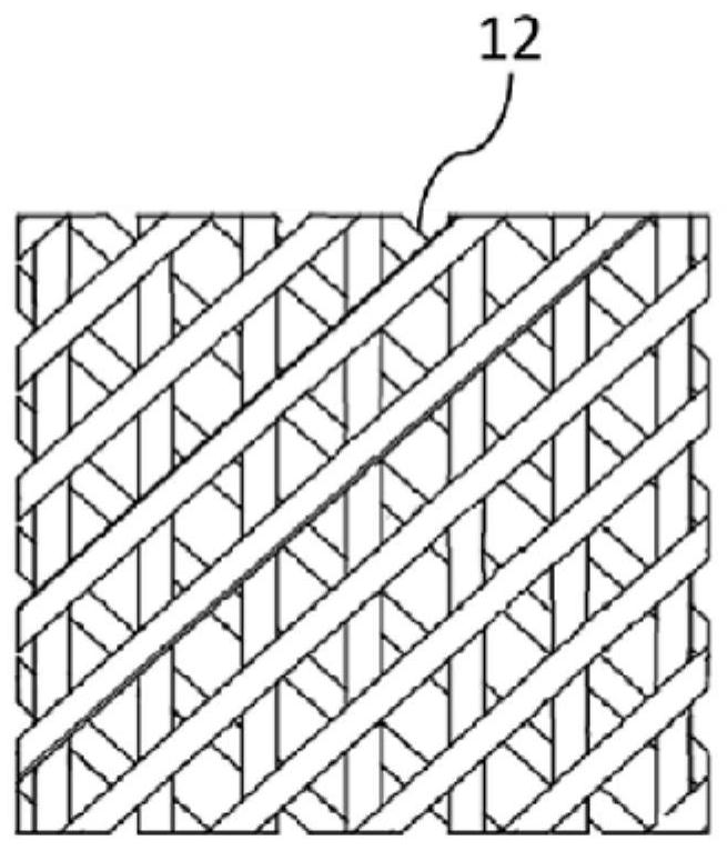 Elastic bionic artificial temporomandibular zygopophysis prosthesis and preparation method thereof