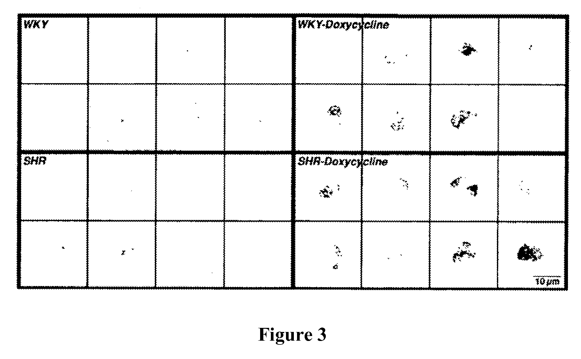 Uses Of Endopeptidases In Treatment Of Disease