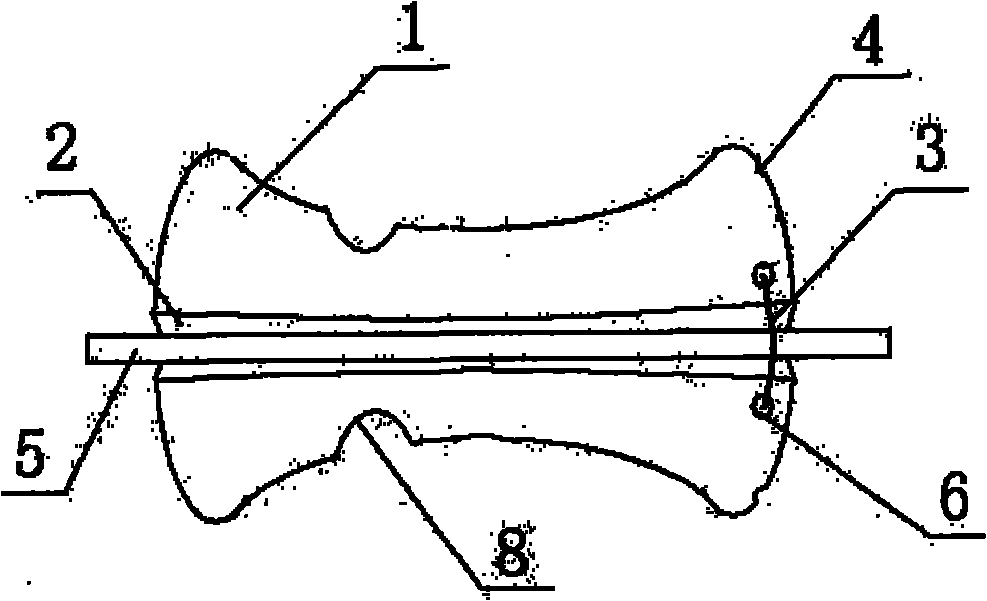 Tracheal cannula fixing device