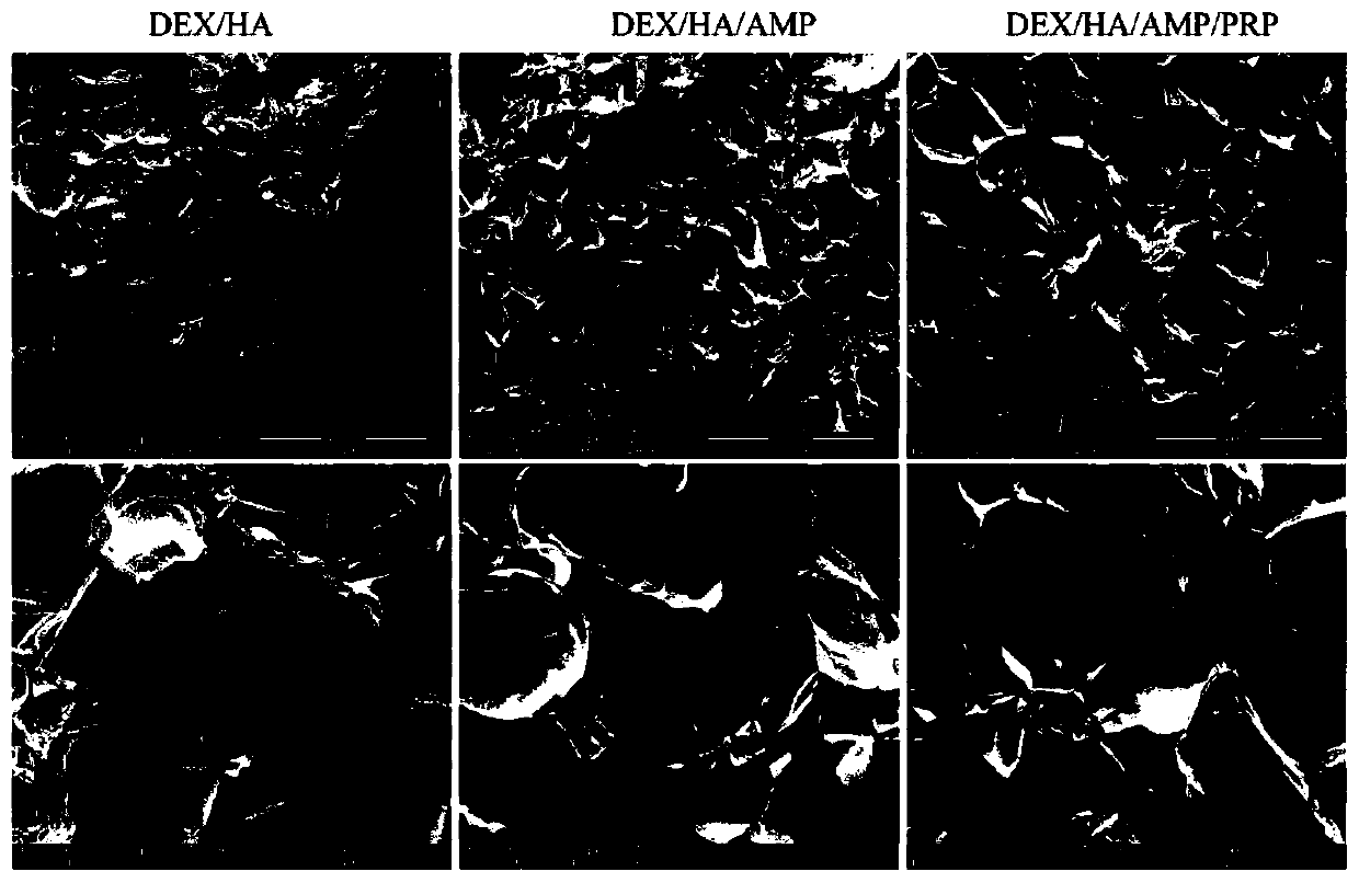 Hydrogel loaded with platelet-rich plasma and antibacterial peptide as well as preparation method and application of hydrogel