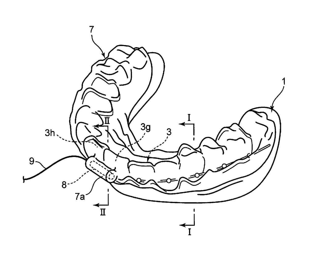 Dental vibration application method and dental vibration application device