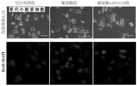 Application of type-II cannabinoid receptor agonist in preparation of drugs for treating hypertensive cerebral hemorrhage