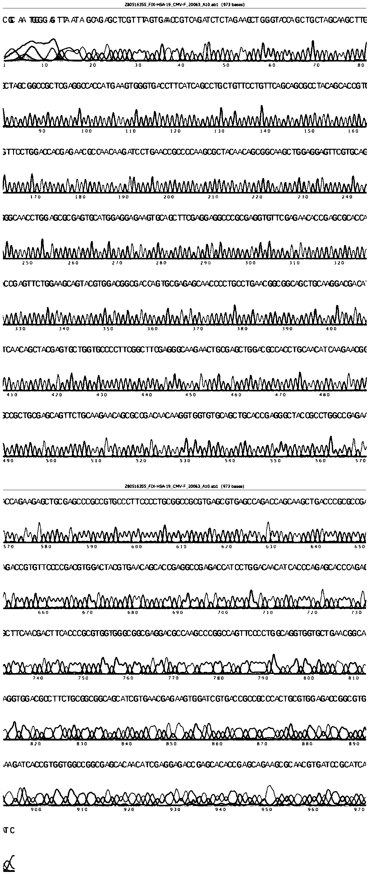 Vector for expressing recombinant blood coagulation factor FIX and construction method and applications thereof