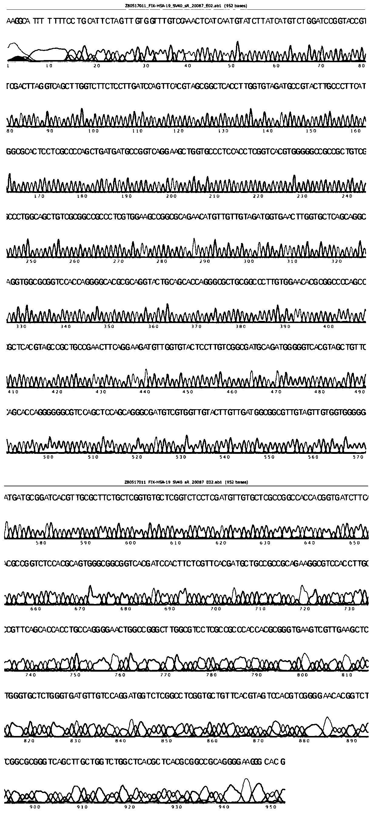 Vector for expressing recombinant blood coagulation factor FIX and construction method and applications thereof