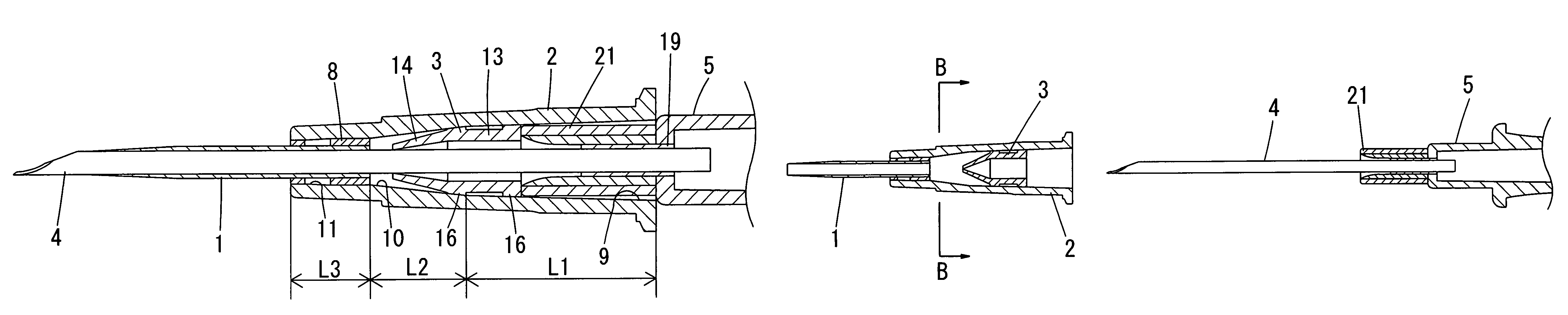 Indwelling catheter