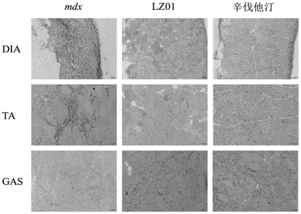 Application of LZ01 in treatment of Duchenne muscular dystrophy