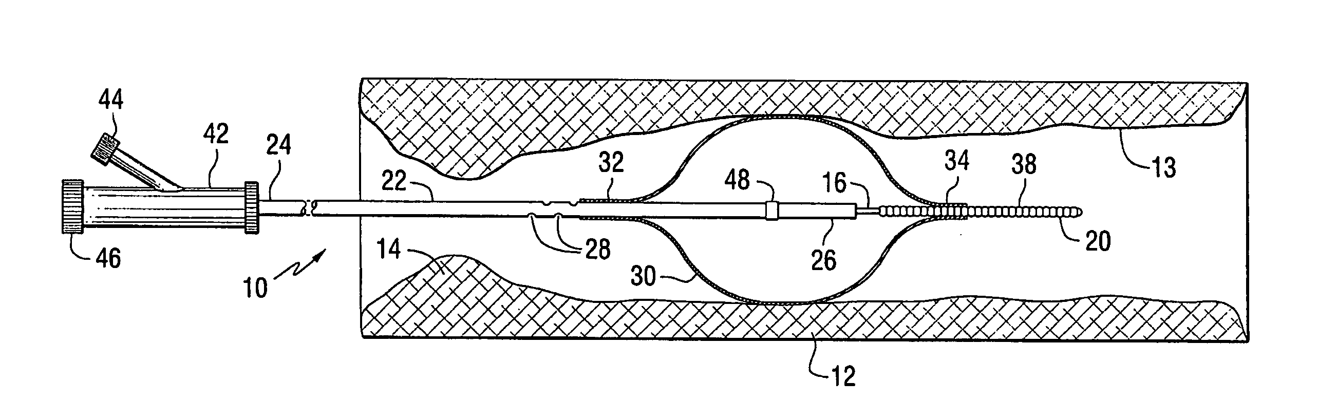 Apparatus for thromboembolic protection