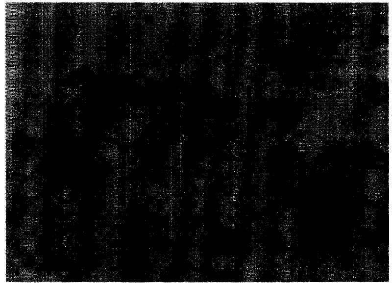 Comprehensive detection kit for early carcinoma of prostate, detecting method and use thereof