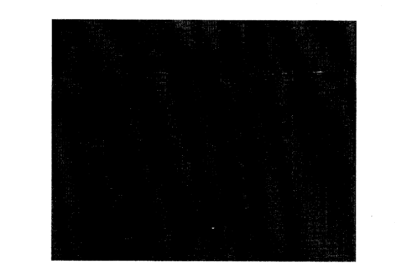 Comprehensive detection kit for early carcinoma of prostate, detecting method and use thereof