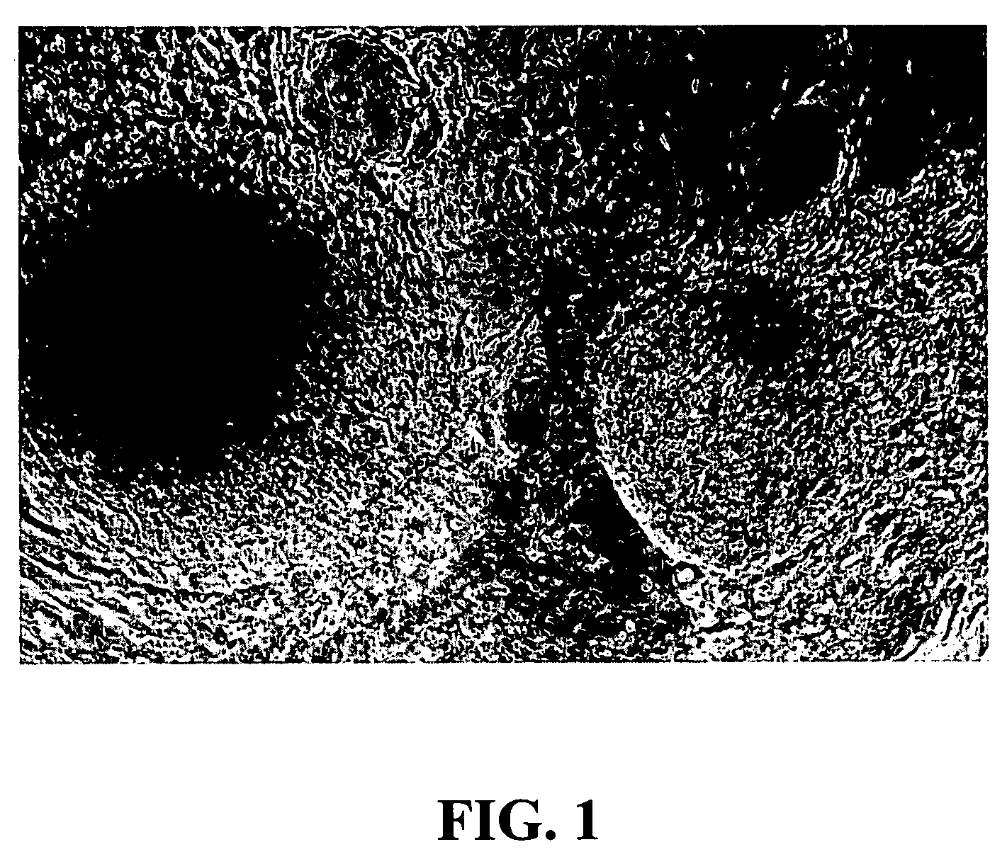 Abscissic acid and derivatives thereof for the treatment of diseases