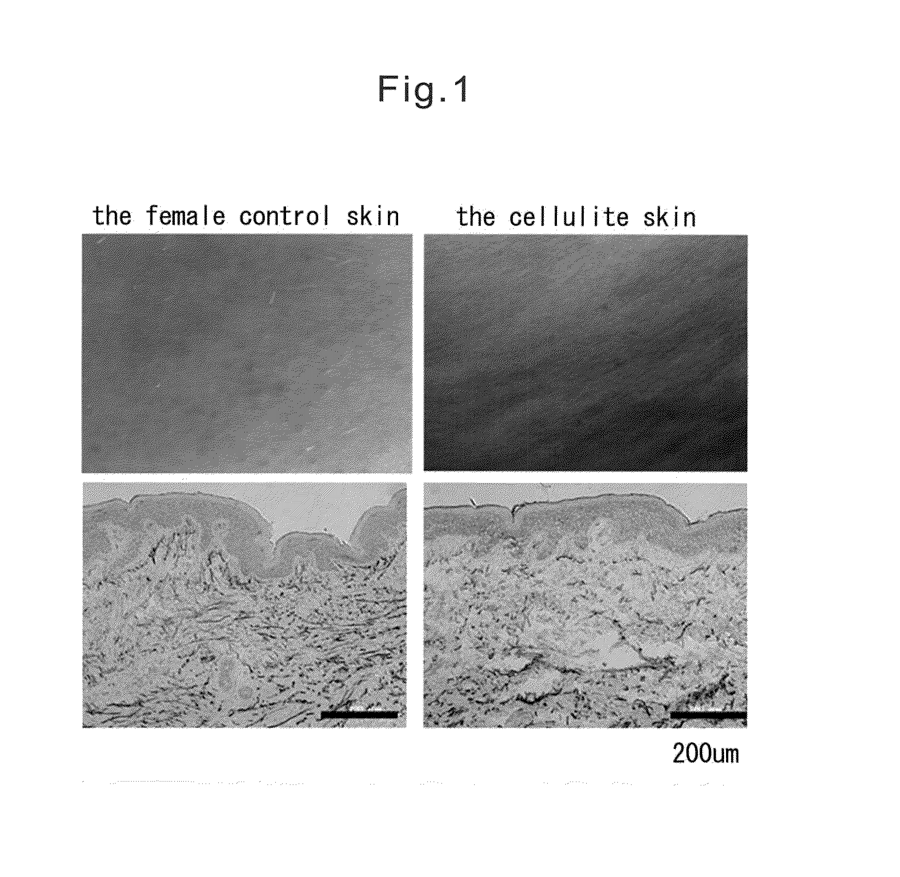 Method of evaluating cellulite and method of evaluating cellulite-effective drug using fibulin-3 and/or sarcoglycan gamma as an indicator