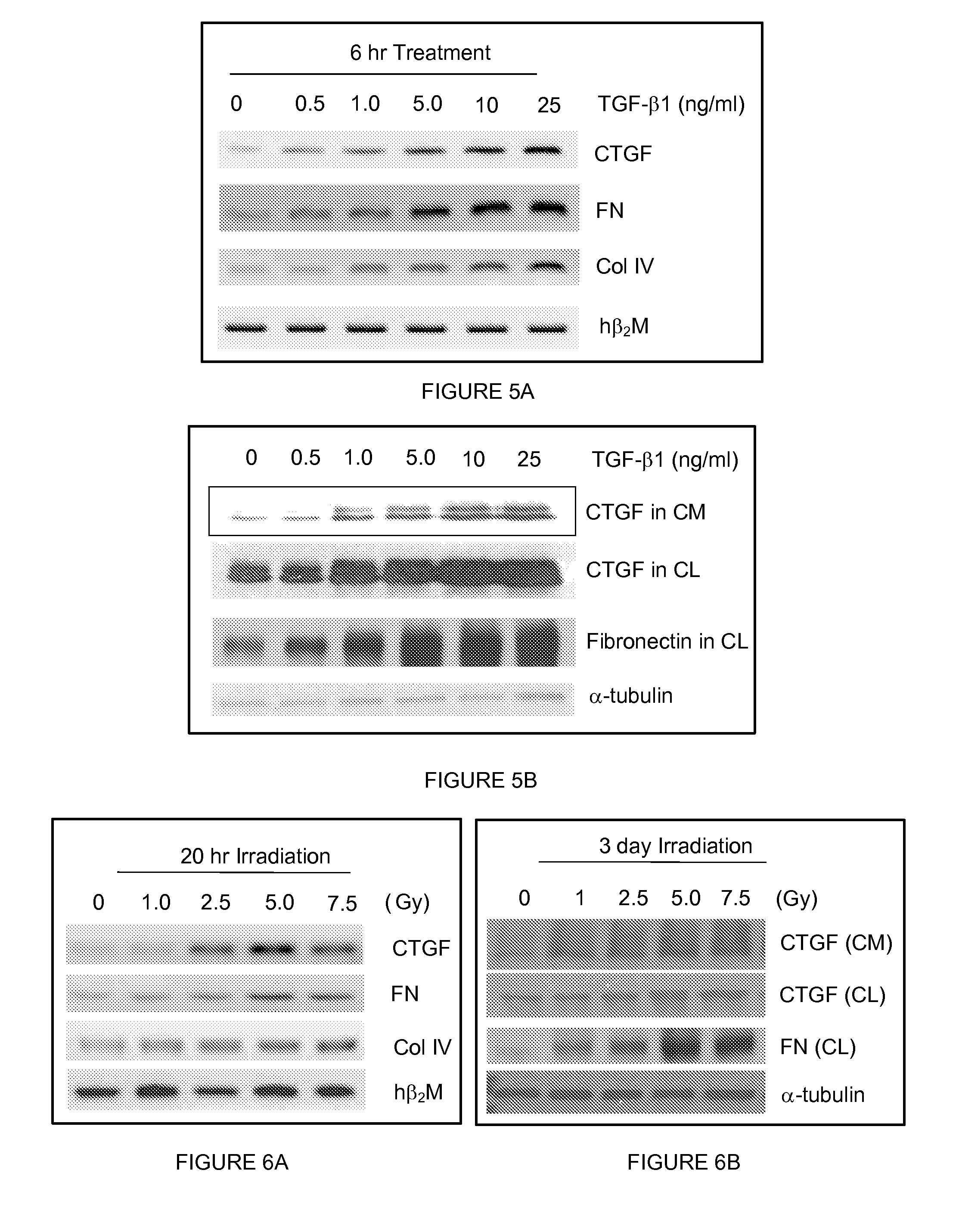 Methods and compositions for treatment or prevention of radiation-induced fibrosis