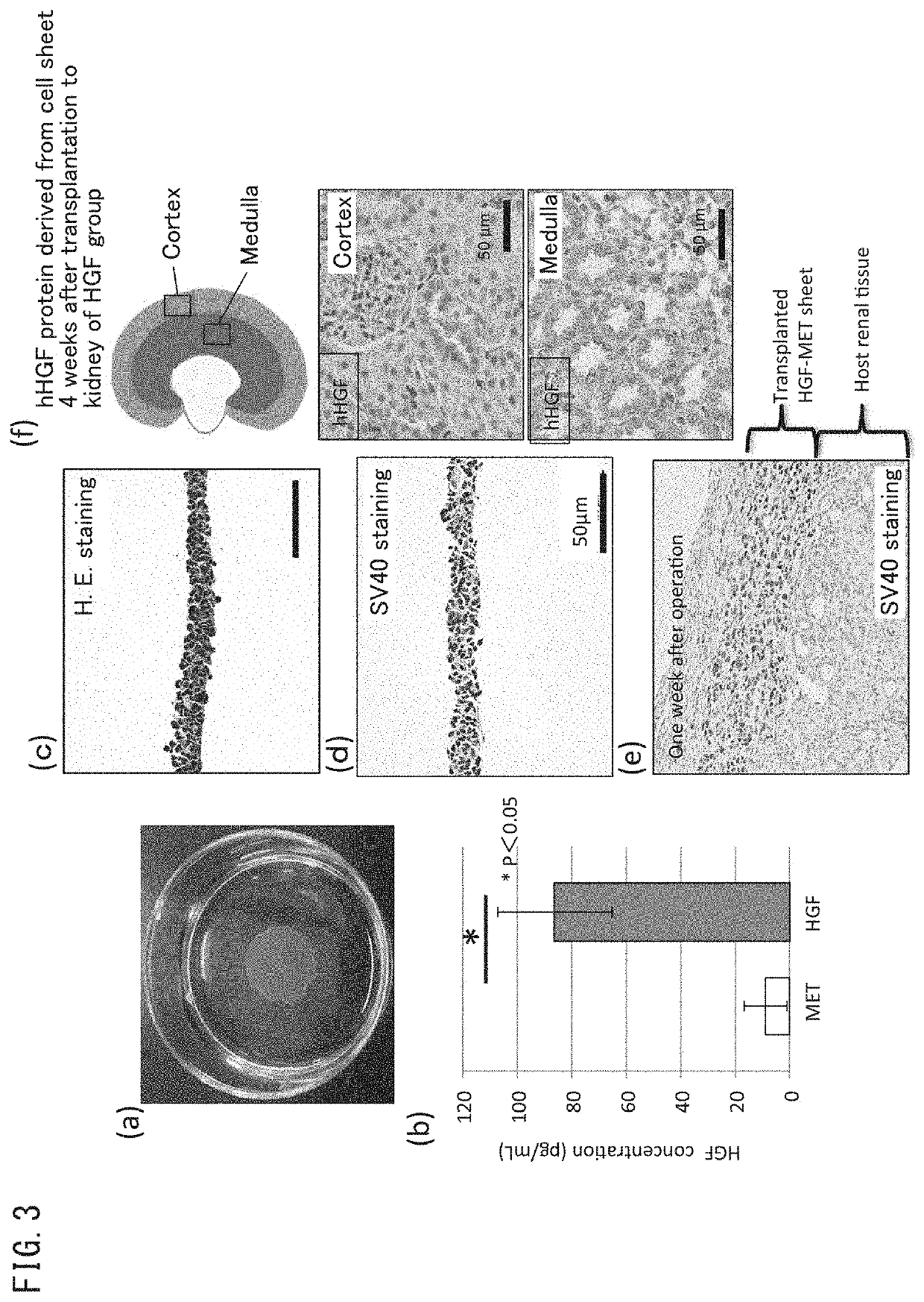 Cell sheet composition for inhibiting progression of renal disorder, method of producing the same, and method of inhibiting progression of renal disorder using the same