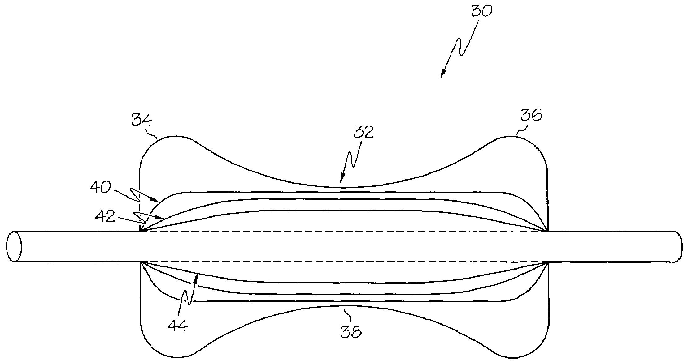 Airway balloon dilator