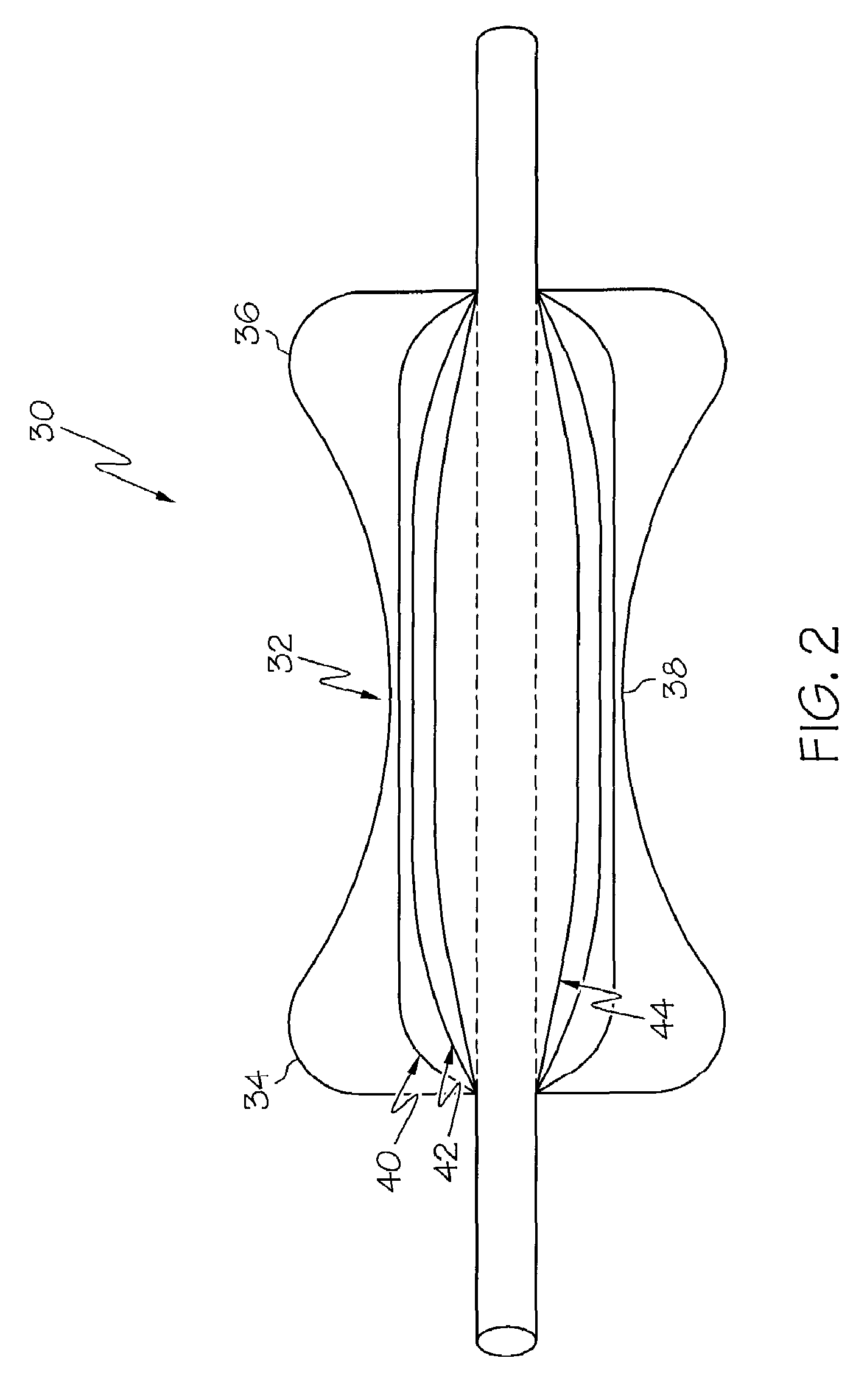 Airway balloon dilator