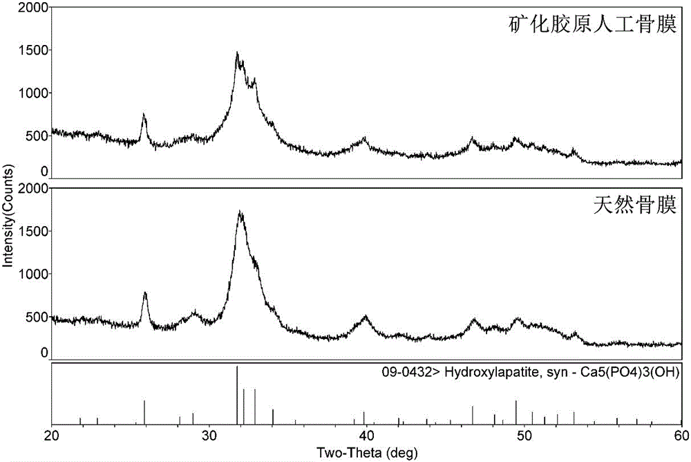 Mineralized collagen artificial periosteum and preparation method thereof