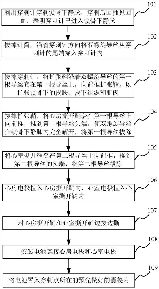 Subclavian vein puncture method for double-cavity pacemaker implantation surgery