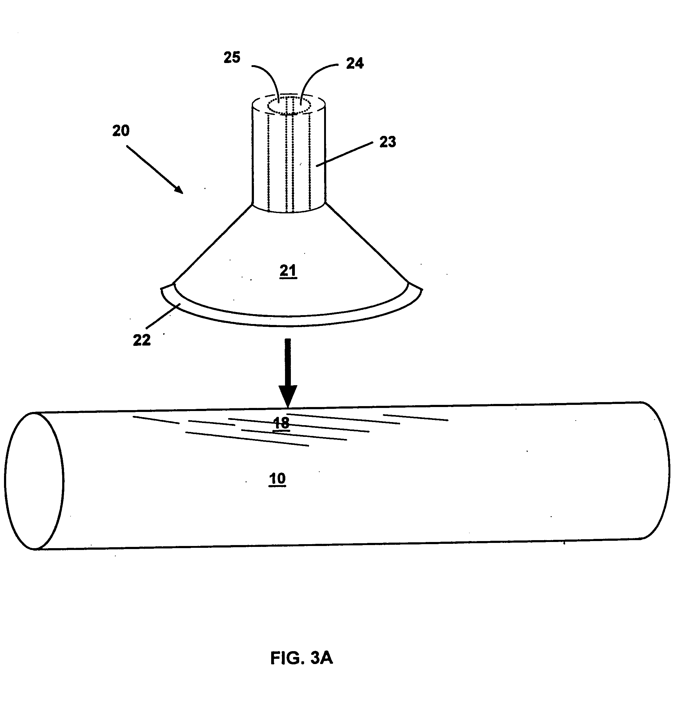 Methods and devices for reducing the mineral content of a region of non-intimal vascular tissue