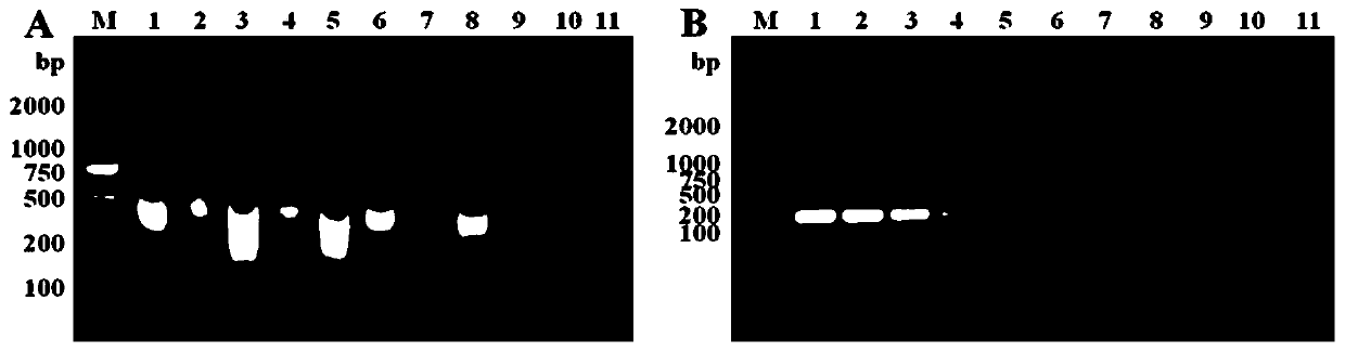 LAMP detection reagent kit of food-borne yersinia enterocolitica and application of LAMP detection reagent kit