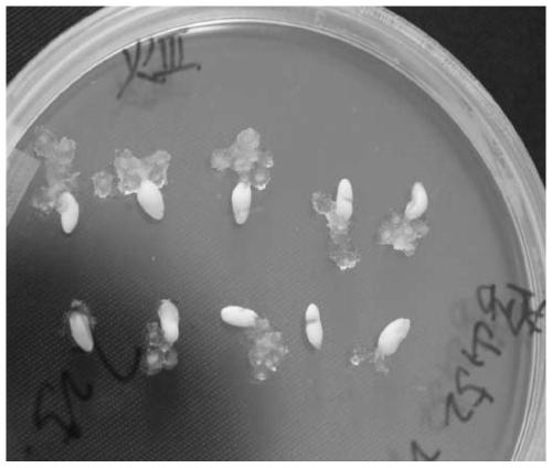 Method for inducing loblolly pine embryonic callus, and dedicated culture medium thereof